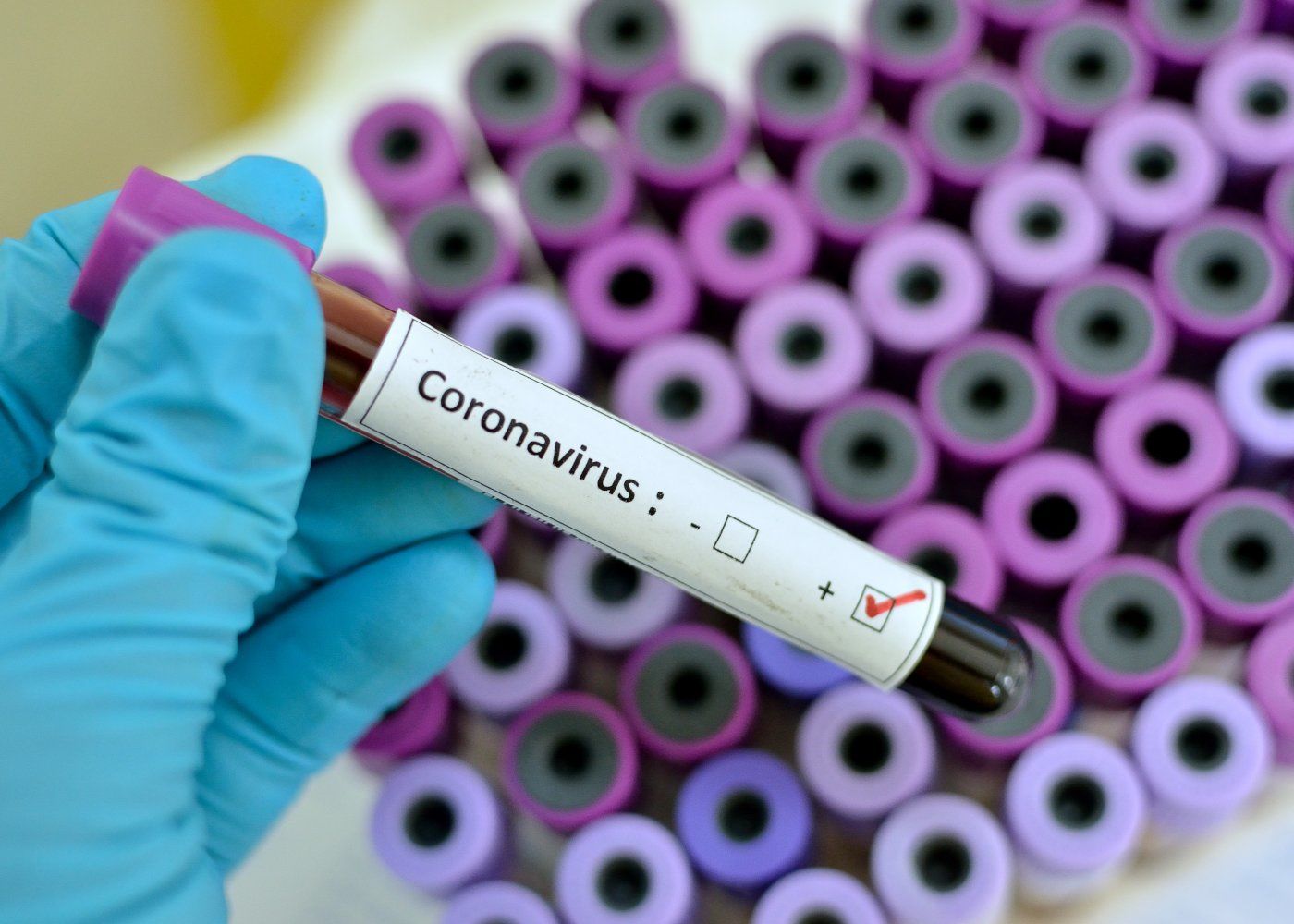 Coronavirus IWA 2020